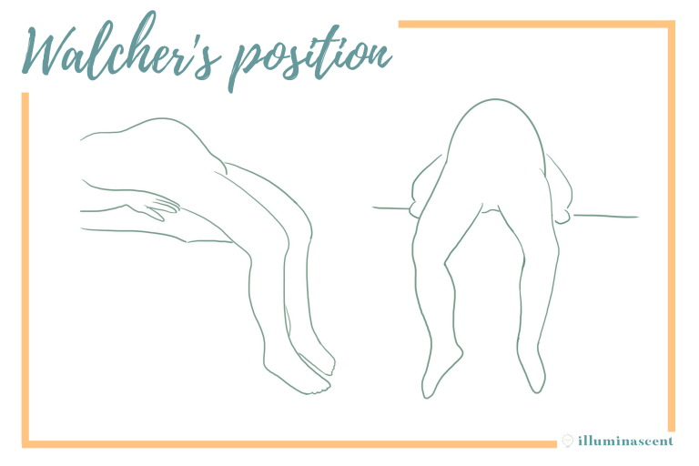 Two great positions for progressing early labour in childbirth 6 1 Walcher's position