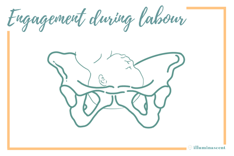 pelvic engagement during labour childbirth