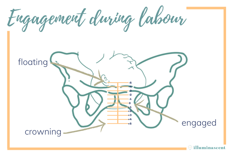 pelvic engagement by station labour childbirth